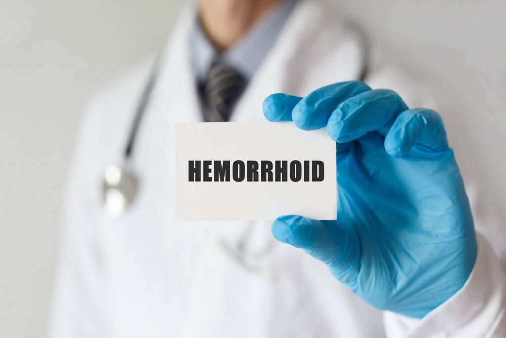 Hemoroid Nasıl Geçer?