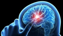 Epilepsi Neden Olur? Bulaşıcı mıdır? Belirtileri ve Tedavi Yöntemleri Hakkında