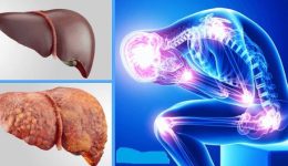 Karaciğer Sorunu Olduğunu Gösteren 8 Önemli Belirti